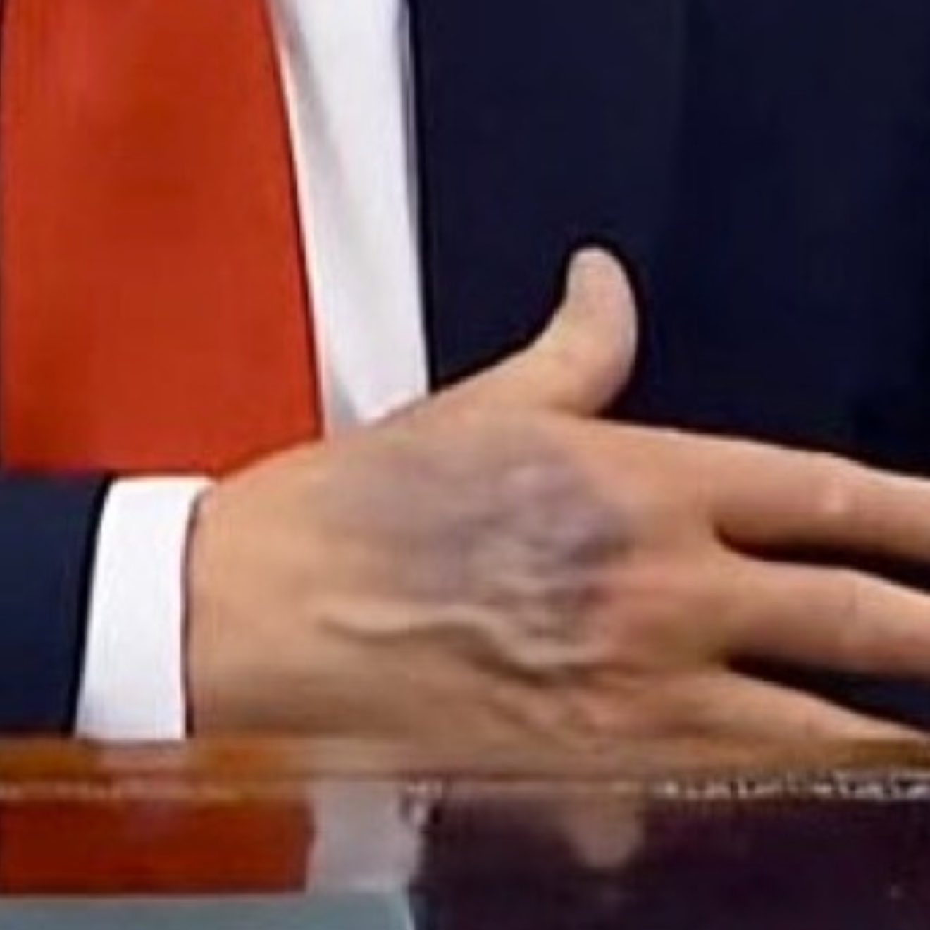 The Curious Case of the Blue Blot on Trump’s Hand